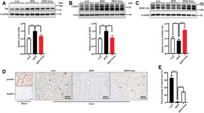 Fenofibrate Improves Insulin Resistance and Hepatic Steatosis and Regulates the Let-7/SERCA2b Axis in High-Fat Diet-Induced Non-Alcoholic Fatty Liver Disease Mice